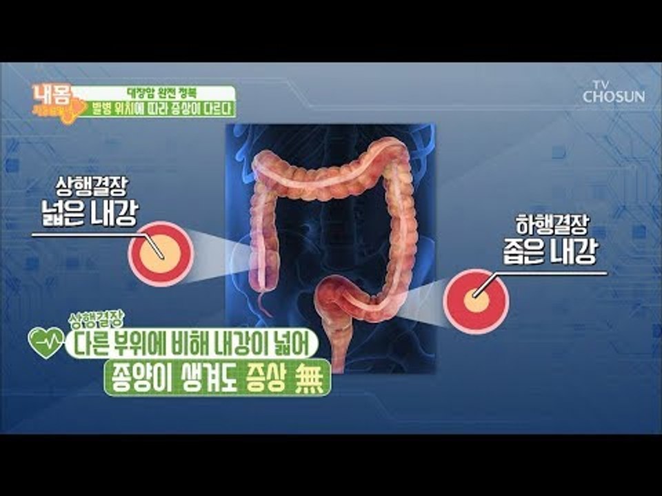 대장암 발병 ‘위치’에 따라 증상도 다르다?! [내 몸 사용설명서] 232회 2018...