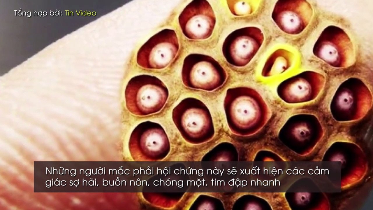 MS GIẢI MÃ BÍ ẨN NHỮNG NỖI SỢ HÃI PHỔ BIẾN TRÊN THẾ GIỚI, SỐ 9 CÓ NHIỀU NGƯỜI SỢ NHẤT