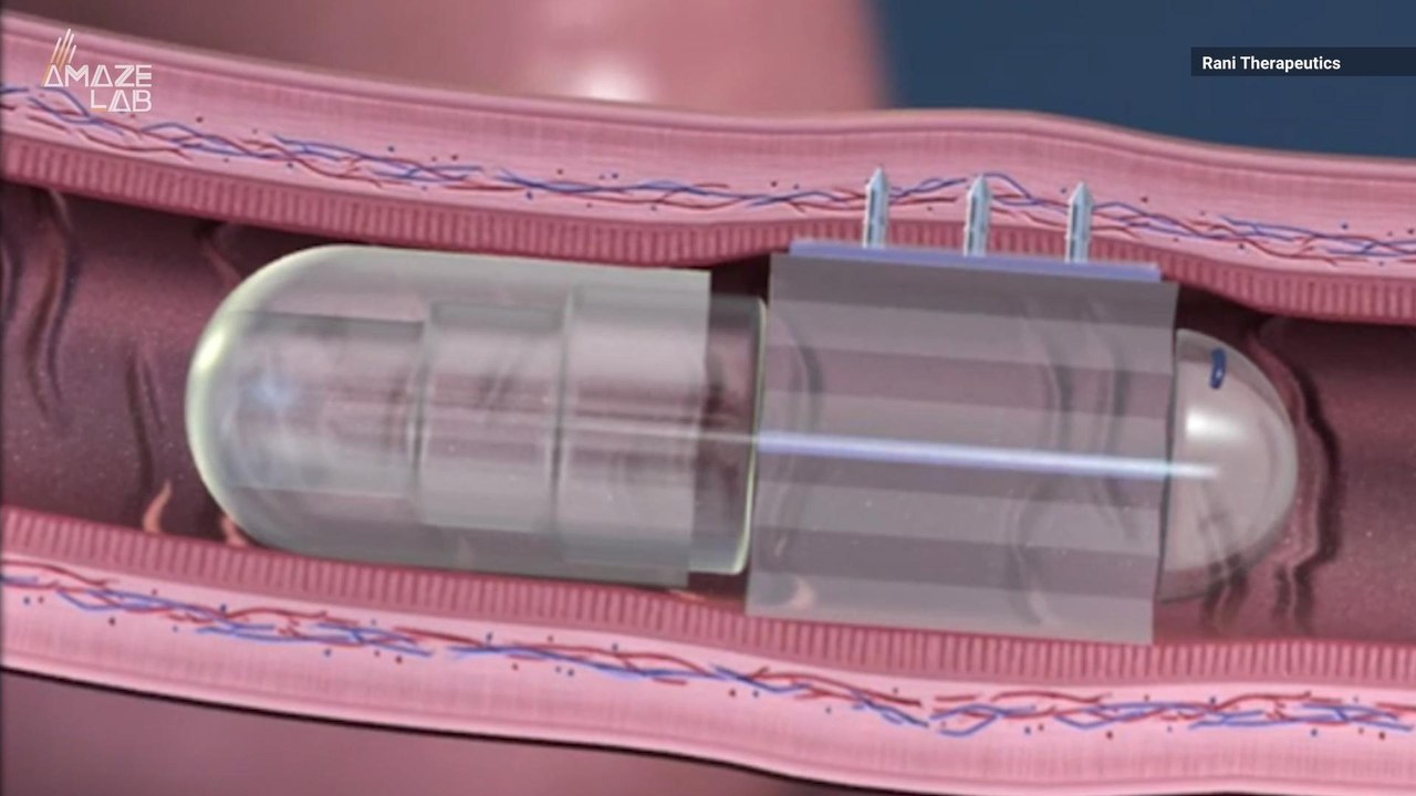 ‘Robotic’ Pill That Could Replace Injections Passes First Human Trial