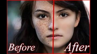 PHOTOSHOP - How to remove acne  pimple  make skin smooth