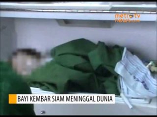 Bayi Kembar Siam Meninggal Dunia