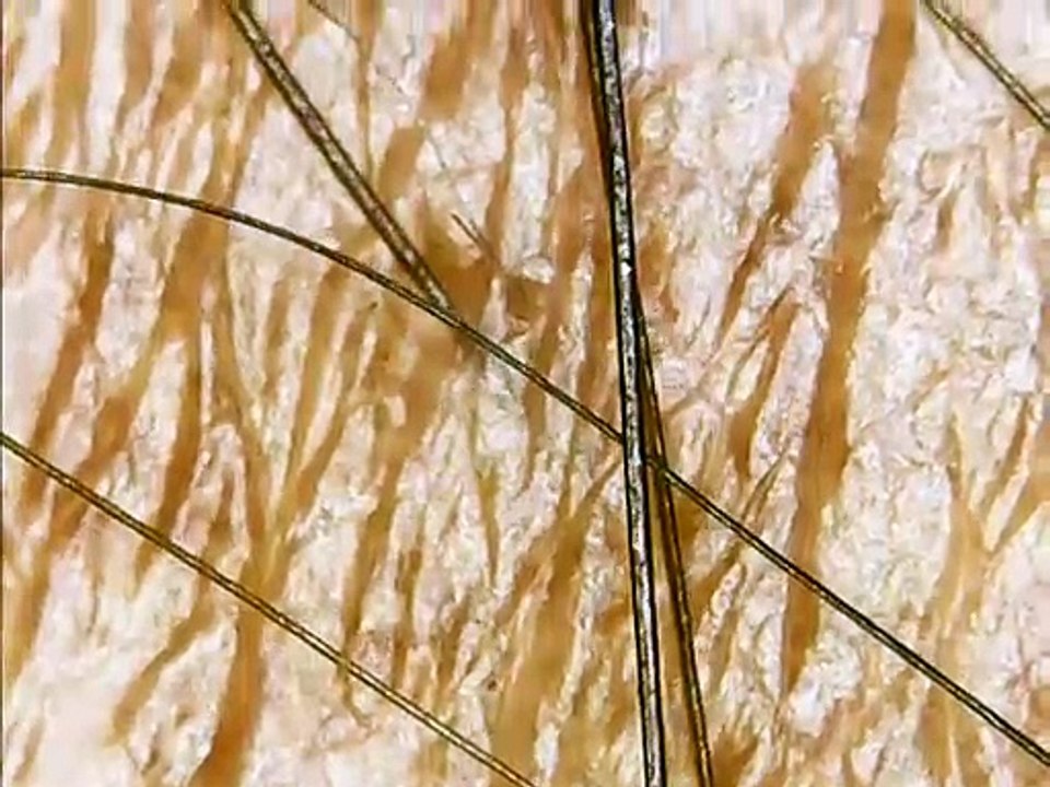 microscopic view of human skin, hair and hair root