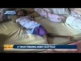 21 Tahun Terbaring Akibat Cacat Polio