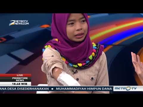 Selamat dari Ledakan Pabrik Kembang Api, Fitri Terima Rp5 Juta dari Perusahaan