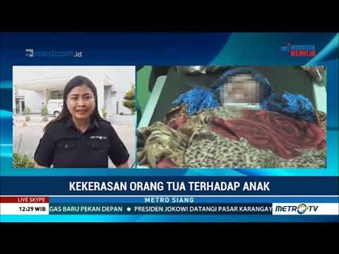 Siswi SD di Sulut Dibakar Ibu Kandung