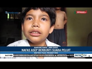 Asep Bersuara 'Terompet' Karena tak Sengaja Telan Peluit