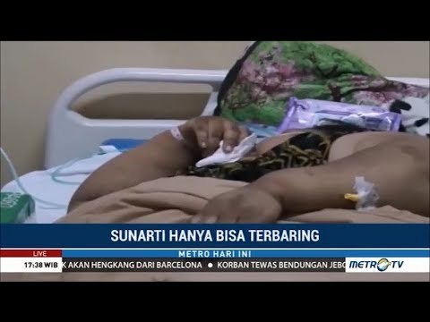 RSHS Bentuk Tim Khusus Tangani Obesitas Sunarti