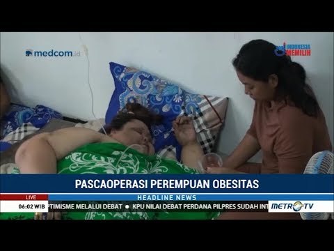 Usai Jalani Operasi, Kondisi Titi Wati Terus Membaik