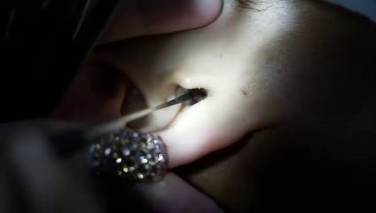 김포출장마사지【후불1ØØ%ョ】Ø7Ø_5222_78Ø2【카톡ZHF526】##F김포전지역출장안마'김포출장맛사지'샵김포출장마사지'아가씨'출장안마'최저가ФХЦ출장오피출장오피