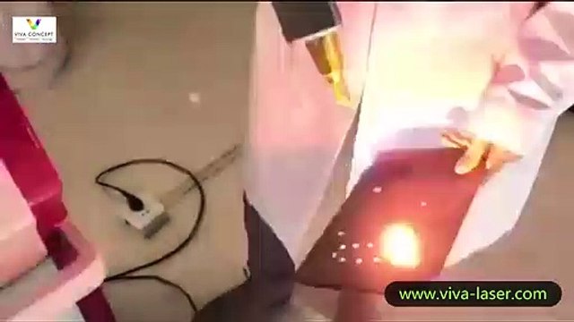Laser tattoo removal machine energy testing