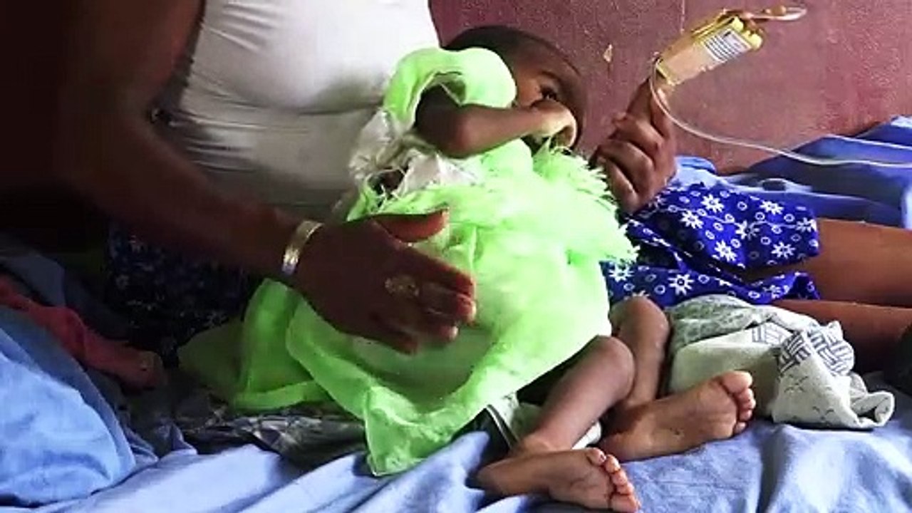 Masernimpfdebatte in Deutschland - Epidemie in Madagaskar