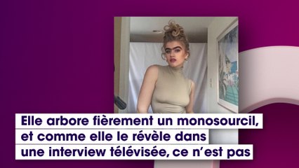 Menacée de mort pour son mono sourcil, ce mannequin réagit !