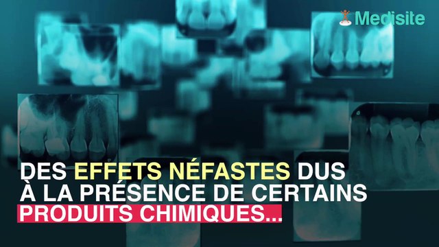 Les kits de blanchiment dentaire sont dangereux pour les dents