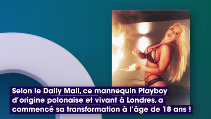 Chirurgie esthétique : elle dépense une fortune pour obtenir un bonnet J