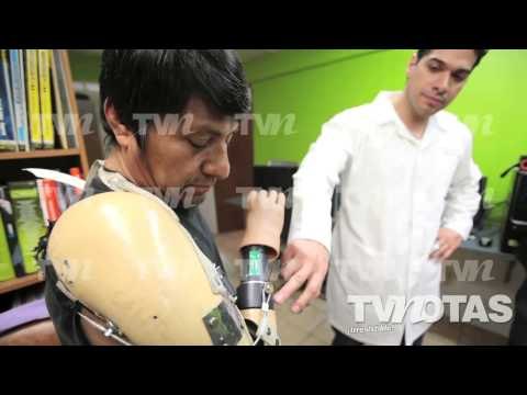 Gente Como Uno - Ellos ayudan a las personas sin manos