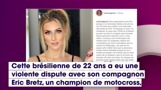 Les photos d’une influenceuse battue par son copain deviennent virales