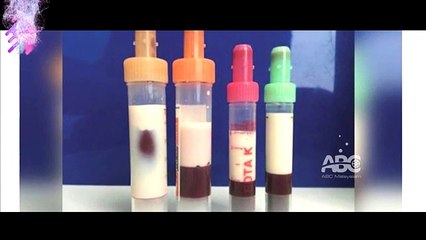 തലകർക്കവുമായി വന്ന രോഗിയുടെ രക്തം പ്രശോദിച്ച ഡോക്ടർ ഞെട്ടി, സംഭവം ഞെട്ടിക്കും