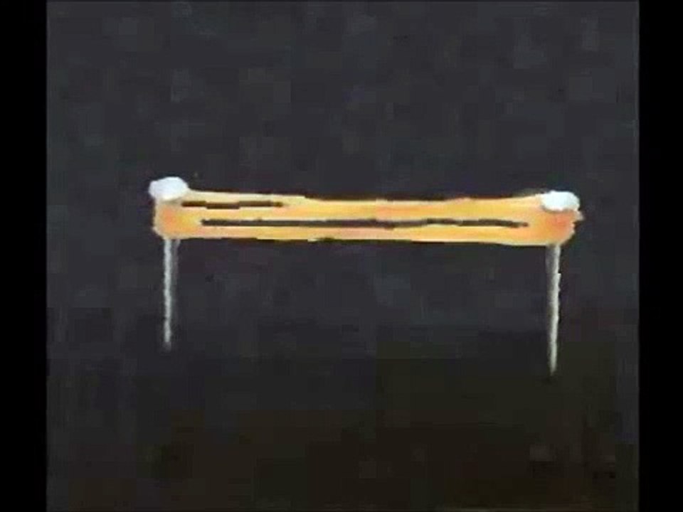 Trigger Point Occurrence (Metaphysical Concept of Taut Band ) 筋肉の変化