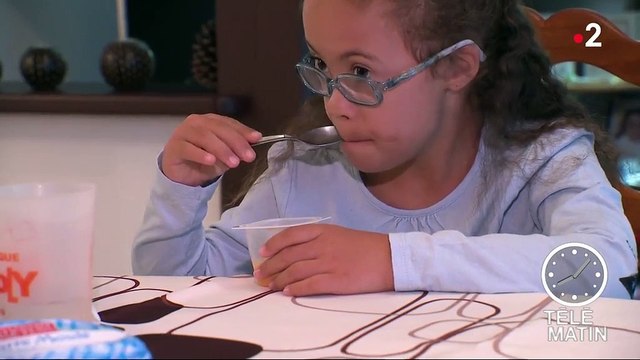 Trisomie 21 : un nouveau type de dépistage prometteur