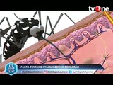 Fakta Nyamuk Demam Berdarah