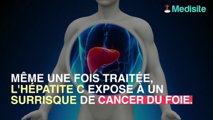 L'hépatite C augmente les risques de cancer du foie