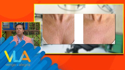 ¡Así es como podemos cuidar y mejorar la piel de escote! | Venga La Alegría