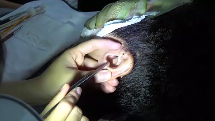 【중구출장안마】1ØØ%ョ후불【Ø7Ø↔7575↔0054 카톡KC789】ぐ【중구출장안마】전지역출장마사지【중구출장안마】출장마사지【중구출장안마】출장마사지'최저가→☞≪'출장콜걸'출장마사지'후기'출장콜걸'출장마사지'후기