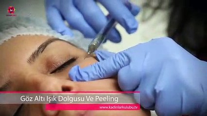 Gözaltı Işık Dolgusu Ve Peeling