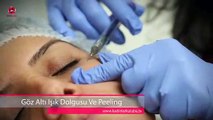 Gözaltı Işık Dolgusu Ve Peeling