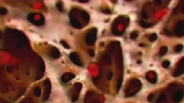 Scientists edge closer to 'cure' for sickle cell