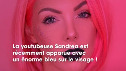 Pourquoi la youtubeuse Sandrea a-t-elle un bleu sur le visage ? Elle s'explique !