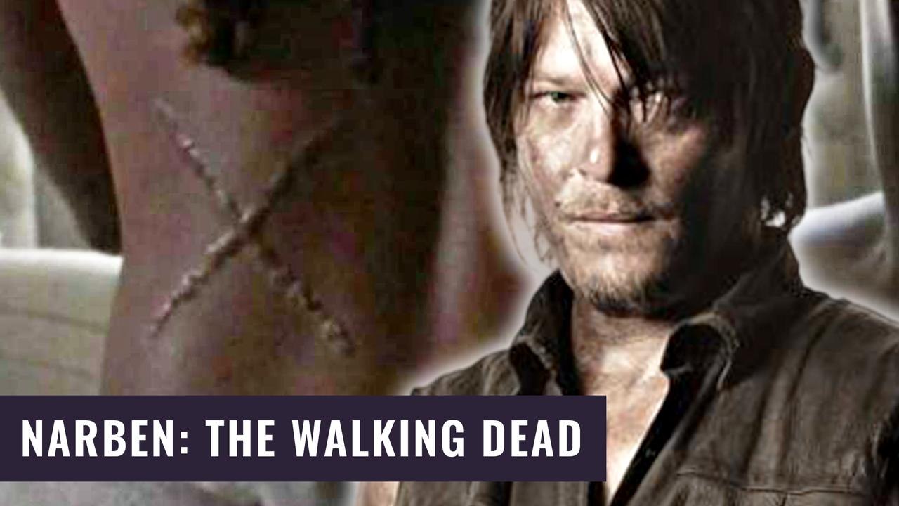 The Walking Dead: Der Ursprung der Narben ist gelüftet! | Alle Easter Eggs aus 9x14