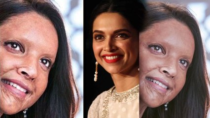 Chhapaak First Look Released ! | Filmibeat Telugu