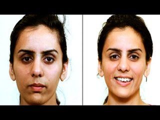 How to get rid of a tan before your wedding