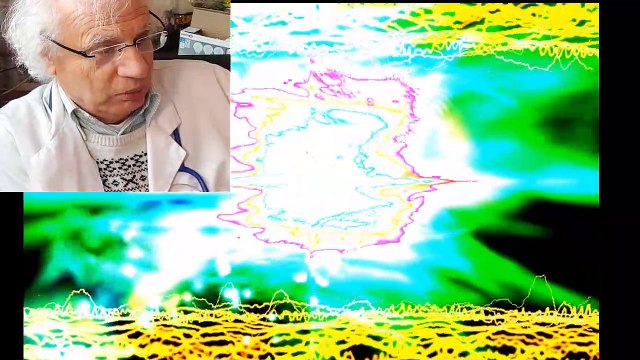 437 ARYTHMIE CARDIAQUES EXTRASYSTOLES PALPITAITON ANGOISSE PANIQUE STRESS