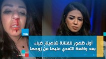 أول ظهور للفنانة شاهيناز ضياء بعد واقعة التعدي عليها من زوجها