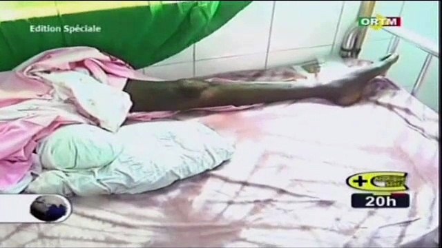 ORTM/Santé - Tout savoir sur le diabète et les complications liées à cette maladie