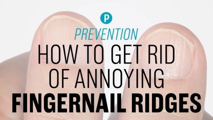 How to Get Rid of Annoying Fingernail Ridges