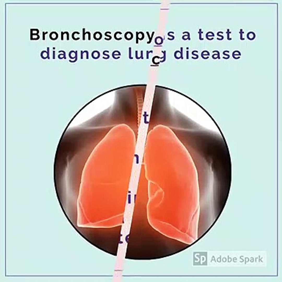 Bronchoscopy in Lung Cancer - PathSOS