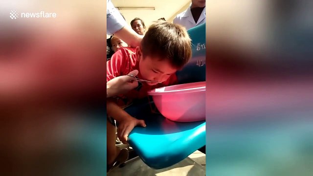 Stomach-churning moment leech is pulled from boy's nose in Thailand