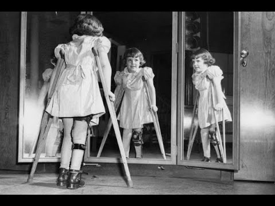 Aparece rara enfermedad parecida a la polio que paraliza a niños | Noticias con Zea