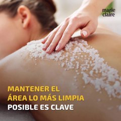 Así puedes tratar y evitar la foliculitis