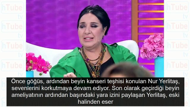 Nur Yerlitaş gizlice ameliyat oldu son görüntüsü korkuttu