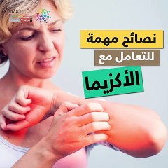 فيديو معلوماتي.. نصائح مهمة للتعامل مع الأكزيما