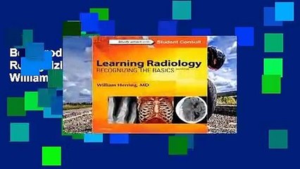 Best product  Learning Radiology: Recognizing the Basics - William   Herring