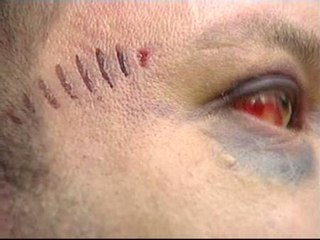 Un detenido por matar a golpes a un rumano