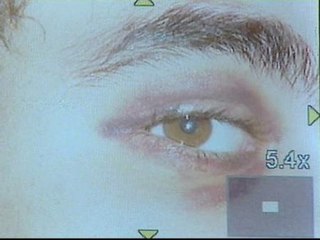 Un joven, agredido por el padre de un compañero