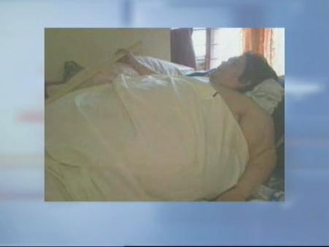 Muere uno de los hombres más obesos del mundo