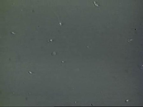 Más de la mitad de los jóvenes españoles tiene un semen de mala calidad