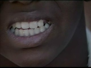 Un pit bull ataca a su propio dueño en Brasil